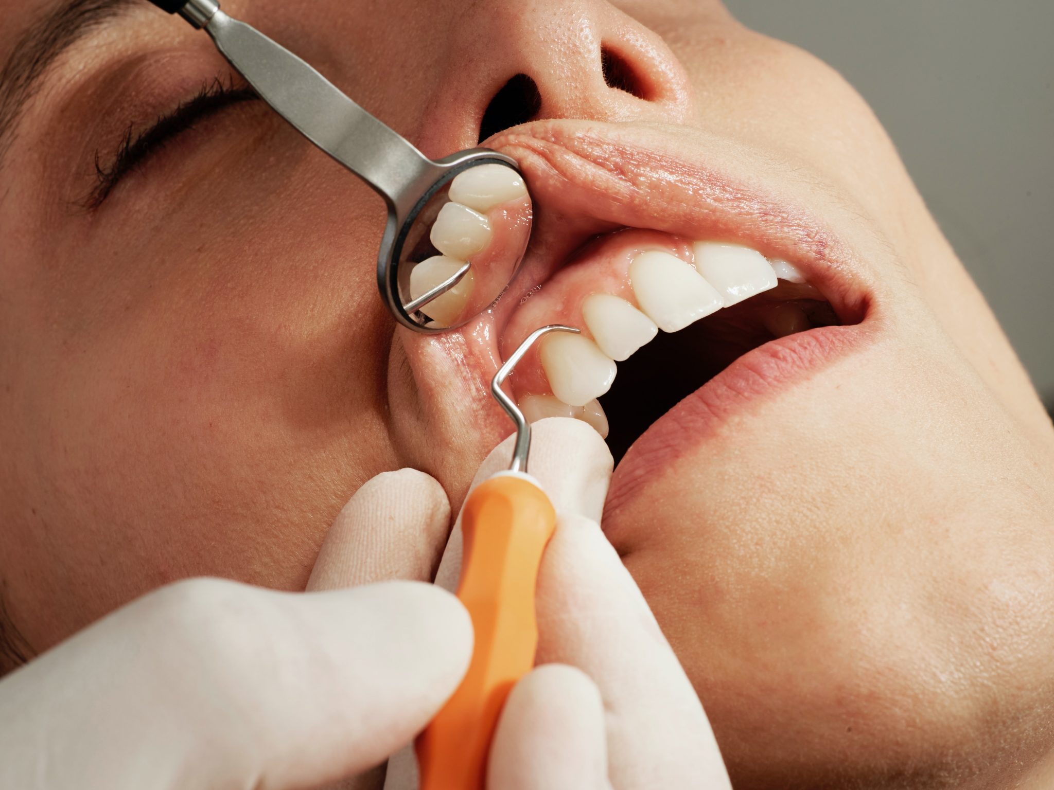 The Importance of Regular Dental Check Ups and Cleanings