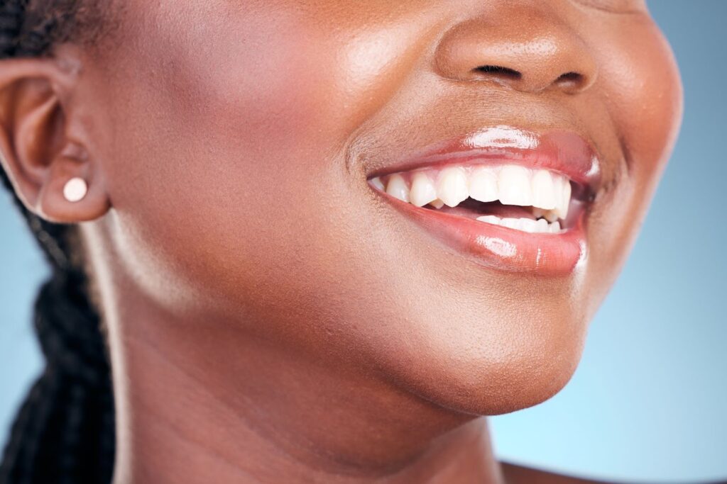 A close up of a young woman smiling with bright white teeth after a teeth whitening appointment.
