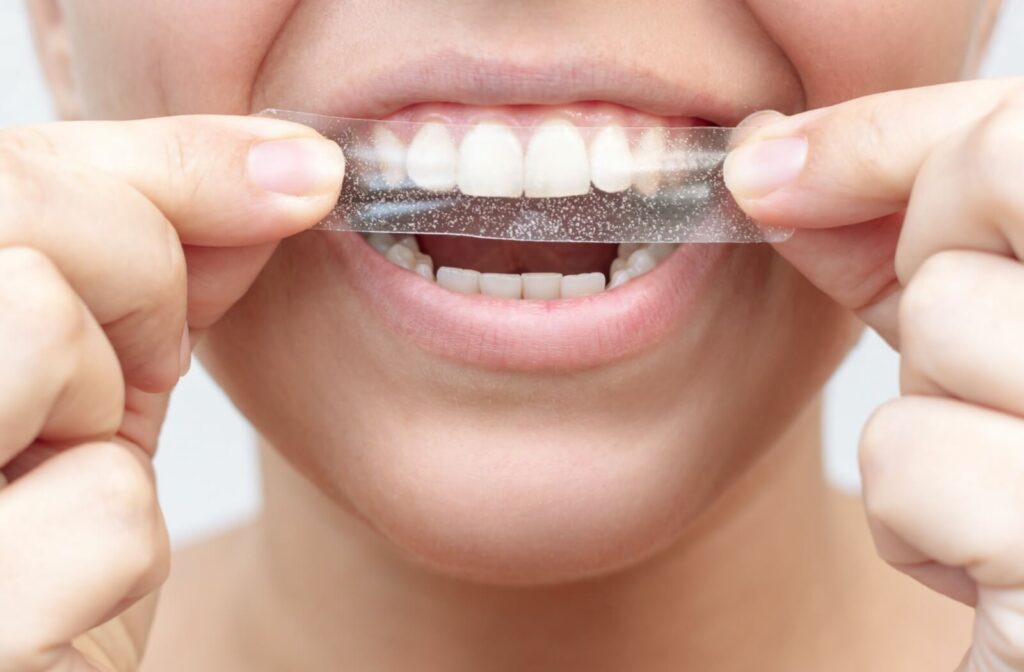 A closeup of someone using at-home whitening strips to whiten their teeth.